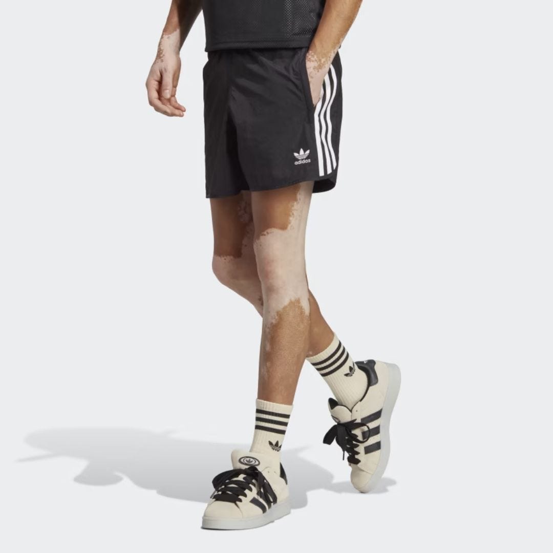 lower half of a man wearing black adidas soccer shorts with white sneakers