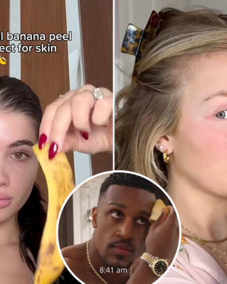 Is rubbing a banana peel on your face good for your skin?